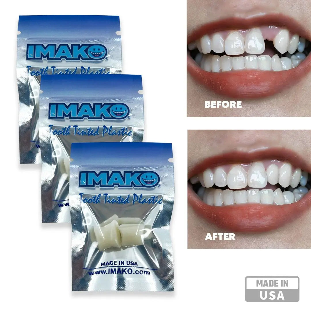 Imako® Tooth Tinted Plastic – Temporary Tooth – For Chipped Tooth & Fill Gaps in Teeth - Imako