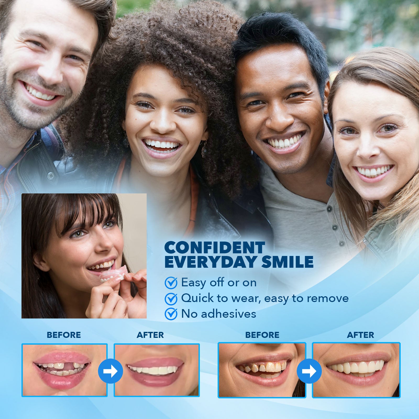 Imako® Cosmetic Teeth Kit
