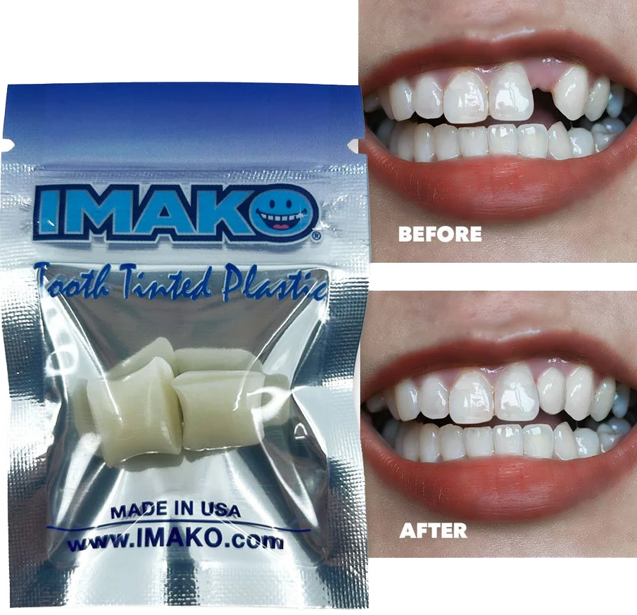 Imako® Temporary Tooth kit for replacing a missing or chipped tooth with a quick, easy solution.