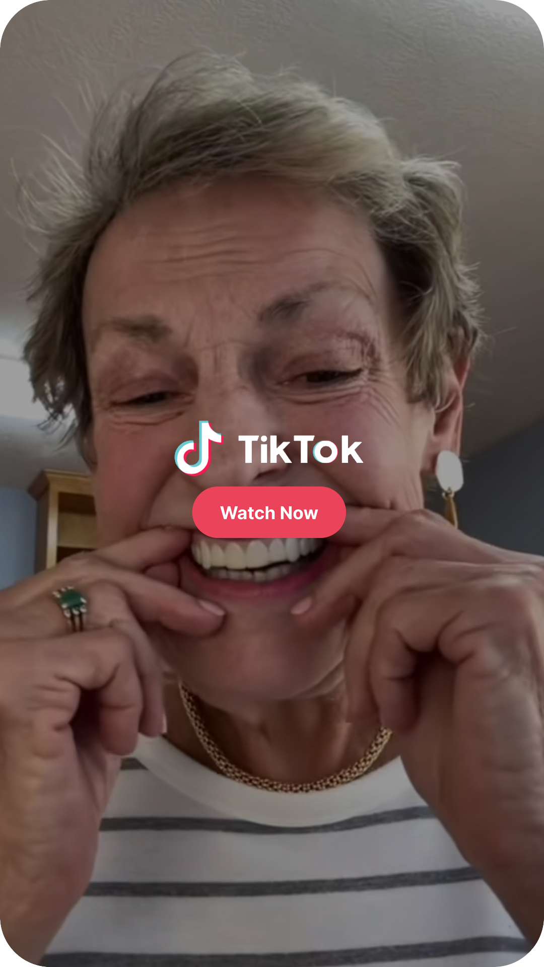 Nancy, founder of Imako®, demonstrating how Imako® Cosmetic Teeth fit over natural teeth.