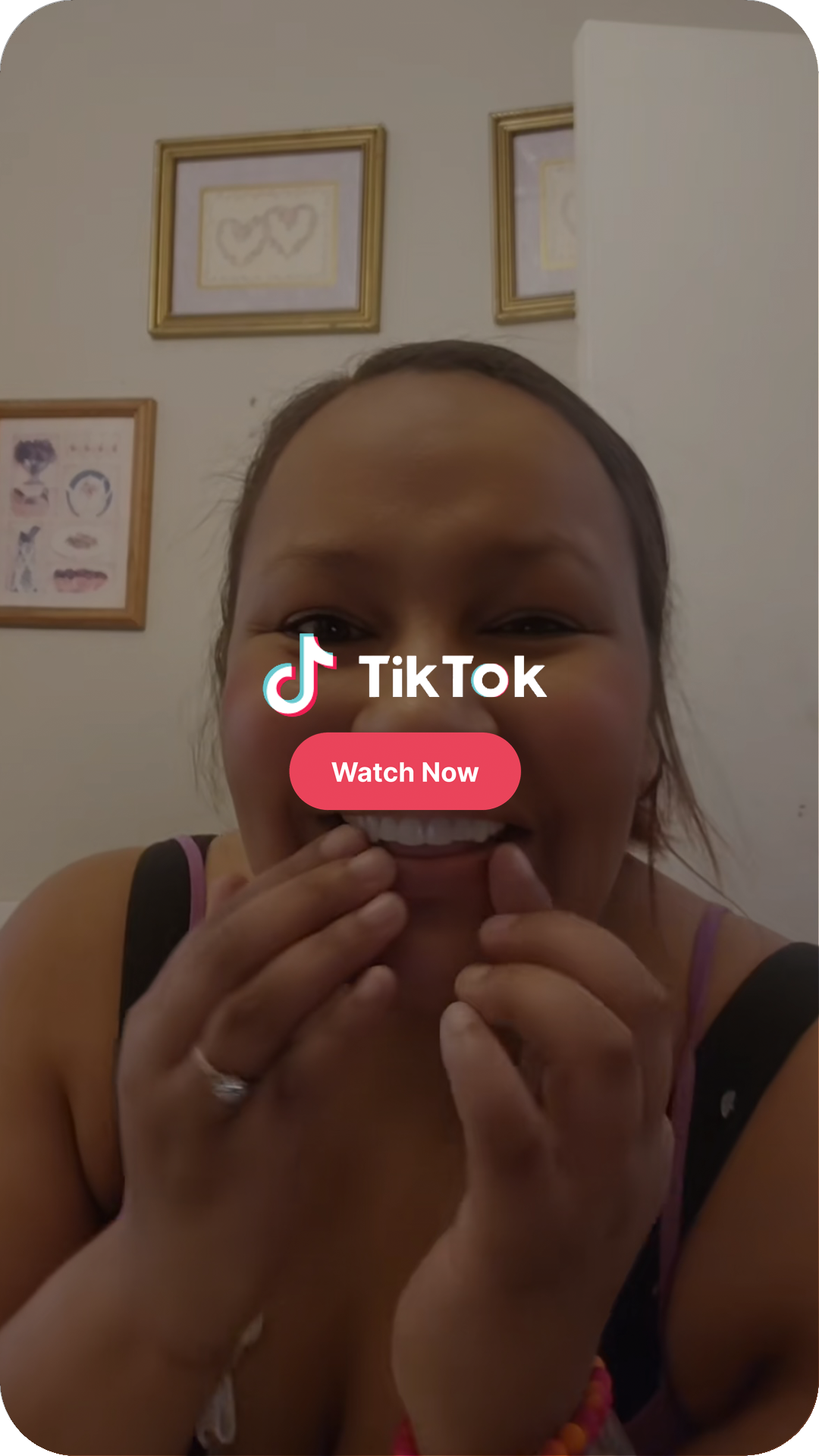 Woman wearing Imako® Cosmetic Teeth for a natural-looking smile makeover.