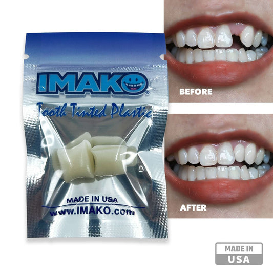 Imako® Tooth Tinted Plastic – Temporary Tooth – For Chipped Tooth & Fill Gaps in Teeth - Imako