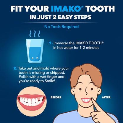 Imako® Tooth Tinted Plastic – Temporary Tooth – For Chipped Tooth & Fill Gaps in Teeth - Imako