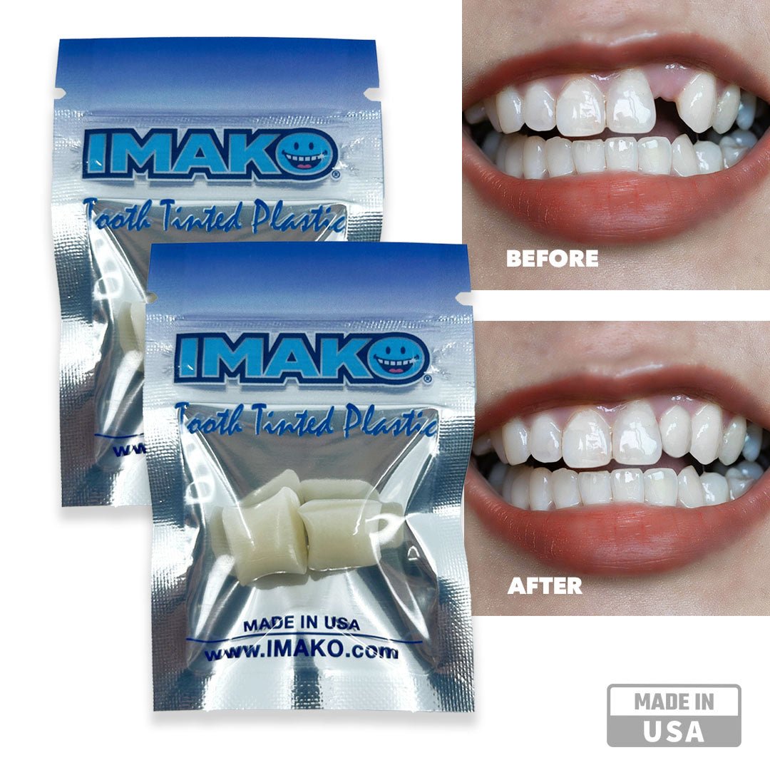 Imako® Tooth Tinted Plastic – Temporary Tooth – For Chipped Tooth & Fill Gaps in Teeth - Imako