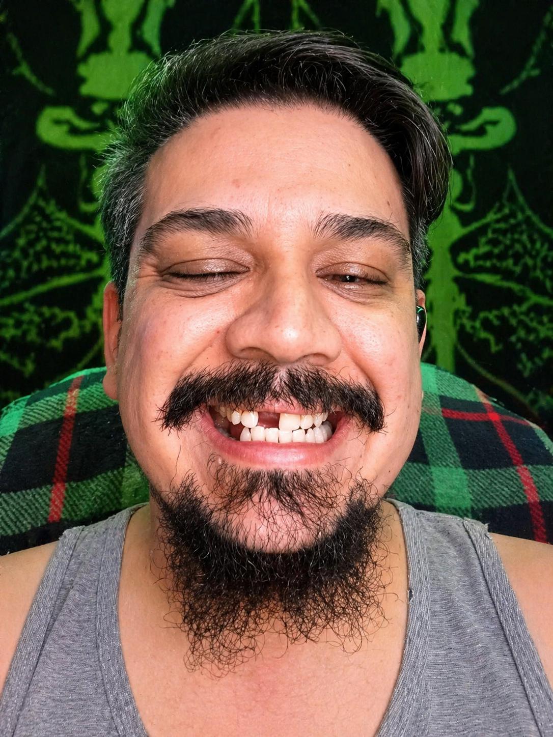 Tooth after Imako Tooth Tinted Plastic